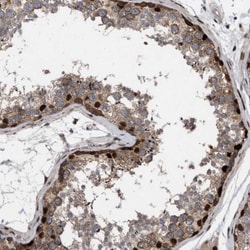 MDMX Antibody, Novus Biologicals 25 &mu;L; Unlabeled:Antibodies, Polyclonal